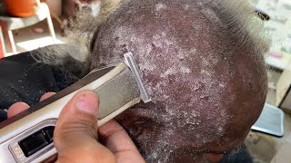 How to remove this dandruff permanently 🥵how to treat dandruff😱💯 [upl. by Lorita438]