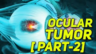 OCULAR TUMOR  PART 2  PATHOPHYSIOLOGY  CLINICAL MANIFESTATION  MANAGEMENT  MEDICAL KA GYAN [upl. by Tandy730]