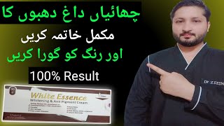 How to get rid of face melasma and dark spots  face whitening cream  Dr review white essence [upl. by Hayn]