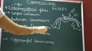 Commissural Fibres Part 1Neuroanatomy Part 11 [upl. by Currey]