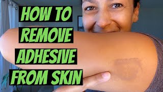 How to Remove Adhesive from Skin [upl. by Kenji]