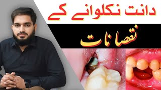 Side Effects of Tooth Extraction دانت نکلوانے کے نقصانات Urdu  Hindi drmuneermalik [upl. by Mattox]