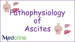 pathophysiology of ascites [upl. by Idnek408]