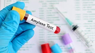 Serum Amylase Test Procedures [upl. by Moraj]