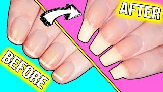 How to GROW YOUR NAILS FAST actually helpful information [upl. by Leviram837]