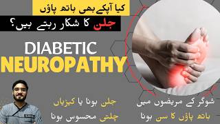 Diabetic Neuropathy Burning Feet syndrome Hath Paon ma JalanDardsunn hona [upl. by Coffeng361]