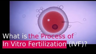 IVF PROCESS HELPFUL STEP BY STEP GUIDE In Vitro Fertilization [upl. by Monahan]