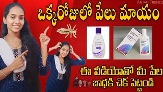 ఏ side effects లేకుండా low budget లో ఒక్క రోజులో పేలు మాయం Clear head lice amp Nits  Anjali Trends [upl. by Notsehc]