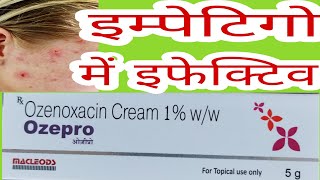 Ozepro Cream Uses in Hindi Ozenoxacin cream Uses in Hindi [upl. by Rizzo]