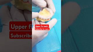 Upper fix teeth  fix teeth  dental bridge  smile makeover  viral shorts asmr [upl. by Kennan]