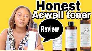 Acwell 55 Toner Honest Review [upl. by Eidnew]