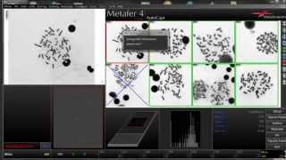 DCScore  Automated Scoring of Dicentric Chromosomes [upl. by Zohar145]