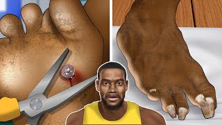 ASMR Animation Pulling nails out of Lebron Jamess soles  WOW Brain Satisfying Toenail [upl. by Neneek]