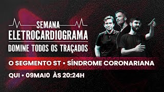 Semana ECG  O Segmento ST [upl. by Tevlev300]