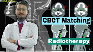 How to match CBCT image in head and neck case  Radiotherapy  Cancer Treatment  sagarshil cancer [upl. by Cire99]