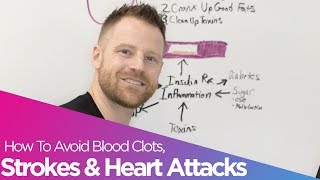 How To Avoid Blood Clots Strokes amp Heart Attacks [upl. by Mar471]