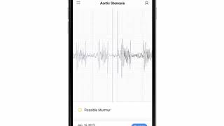 Aortic Stenosis Phonocardiogram  EkoCLINIC App [upl. by Molohs]