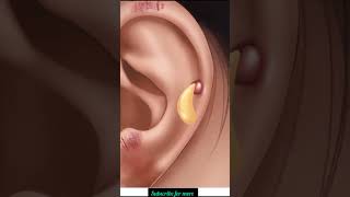 Ear cleaning ASMRasmrgaming [upl. by Annahael]