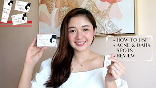 Kojie San Soap  How To Use  Skin Lightening  Acne amp Dark Spots  Review [upl. by Adliw645]