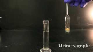 Using a Urinometer [upl. by Macknair]