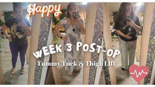 Tummy Tuck amp Thigh Lift Surgery after WLS  Day 15 to 21 PostOp [upl. by Trojan]