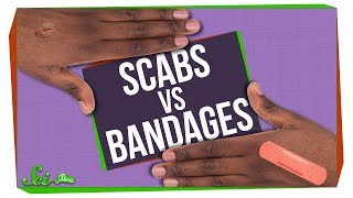 Whats Better for Wounds Scabs or Bandages [upl. by Nrubliw]