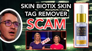 Skin Biotix MD Skin Tag Remover Scam Explained REAL VIDEO [upl. by Ynamrej631]