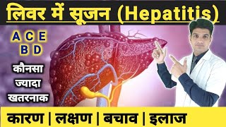 लीवर में सूजन का इलाज  Hepatitis disease complete information [upl. by Einneb]