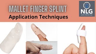 Mallet finger splint applicationeasy application technique [upl. by Enitsud653]