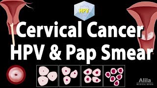 Cervical Cancer HPV and Pap Test Animation [upl. by Town]