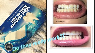 Ebay Advanced teeth Whitening Strips Review [upl. by Atiloj]