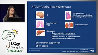 Acute on Chronic Liver Failure A New Disease Entity [upl. by Adehsar298]