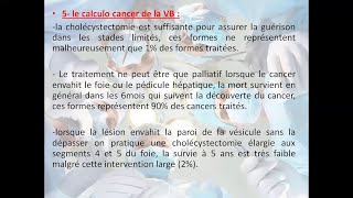 LITHIASE BILIAIRE SES COMPLICATIONS 5 [upl. by Ahsimrac]