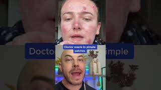 Derm recats to pimple patch removal pimplepopper dermreacts doctorreacts [upl. by Neddie]