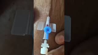 IV cannula insertiondoctertrendingforyoushortvideoviralvideo [upl. by Fischer311]