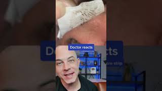 Derm reacts to incredibly satisfying pore strip removal dermreacts porestrip blackheads [upl. by Cataldo904]