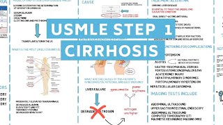 Cirrhosis  USMLE STEP 1 AND 2 [upl. by Aisnetroh]