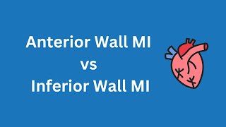 Difference between Anterior wall MI and Inferior wall MI  Myocardial Infarction  medCampus [upl. by Darwen645]