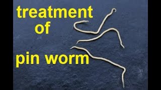 treatment of pin worms [upl. by Anitsyrc992]