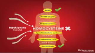 Hyperhomocysteinemia [upl. by Arinayed]