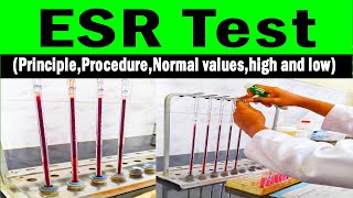 Erythrocyte sedimentation rate  ESR PrincipleProcedureNormal valueshigh and low [upl. by Akirehs29]