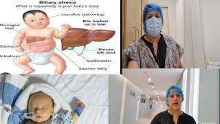 बच्चें को Biliary Atresia बीमारी Drने संभावना बताई preeti k vlogs vlogs 🏥🤱 [upl. by Nnylireg]