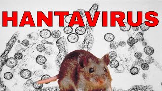 🔴HANTAVIRUS🔴 Hantavirus Síntomas diagnóstico y tratamiento de Hantavirus SUSCRIBETE 🙏👍🔔 [upl. by Canty]