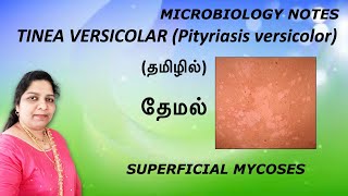 Tinea versicolar Pityriasis versicolar தேமல் Superficial mycosisMicrobiology notes Dr Blessy [upl. by Aesoh]