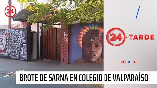 Seremi de Salud confirmó brote de sarna en colegio de Valparaíso 13 casos  24 Horas TVN Chile [upl. by Noram]