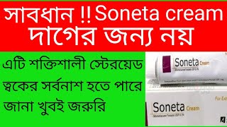 Mukher kalo dag dur korar upay  soneta cream এর কাজ কি অপকারিতা প্বার্শ প্রতিক্রিয়া সতর্কতা। [upl. by Rabassa]