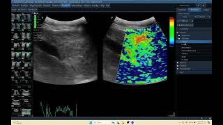 IQ 155 LIVER MASS ELASTOGRAPHY C1 5 RS PROBE ECHOPAC ANALYSIS ULTRASOUND SMALL ANIMAL [upl. by Lemay]