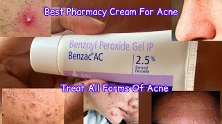 Benzac AC Cream Review  benzac ac 25 review  Benzoyl Peroxide For Acne [upl. by Akeemaj]