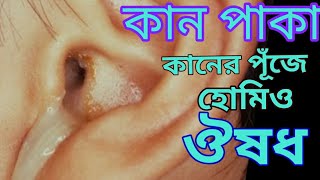 কানে পূঁজ কান পাকার হোমিও ঔষধ [upl. by Aniuqahs]