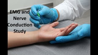 What to Expect EMG and Nerve Conduction Study [upl. by Eedyah]